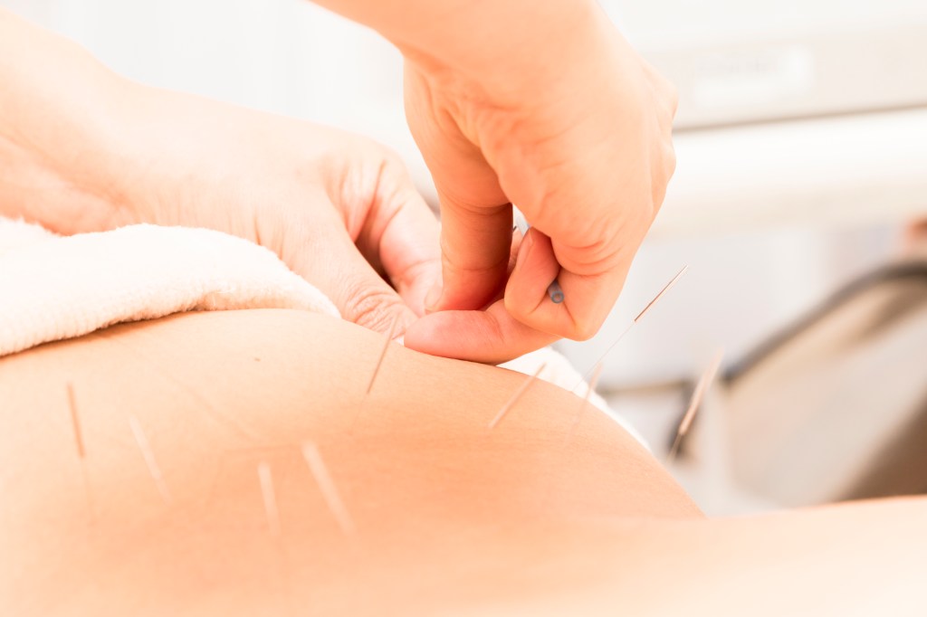 痠痛埋線

用經絡穴位埋線技術，提供長效穴位刺激，深層緩解各類慢性痠痛與緊繃不適。